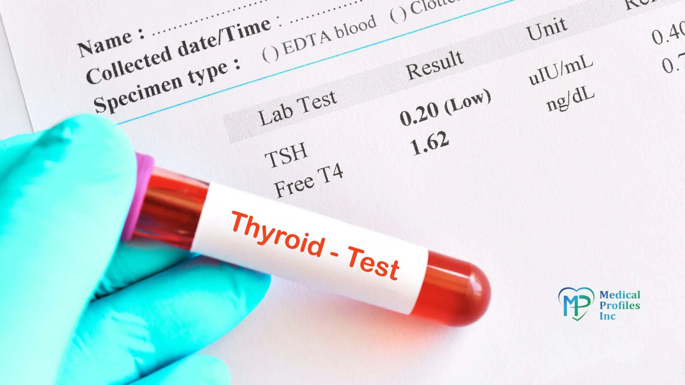 a photo of blood with text "thyroid- test" and laboratory results